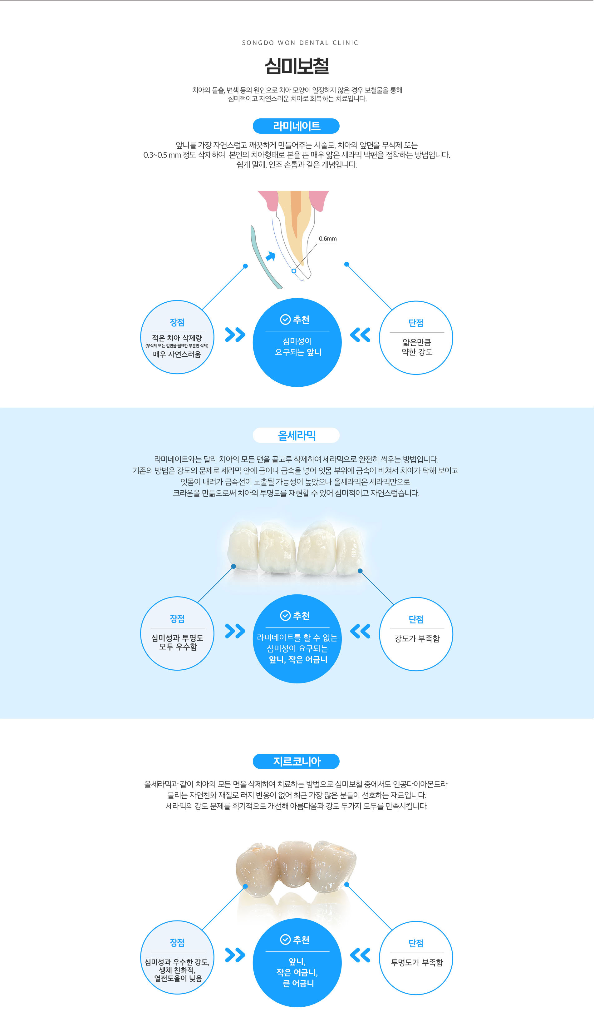 심미보철